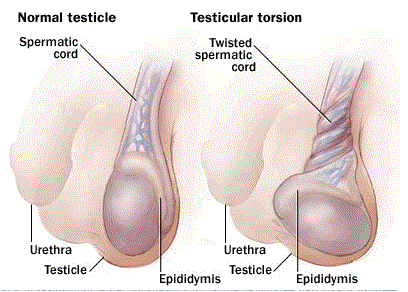 In Pain or Feeling Uncomfortable? You Need Testicular Support